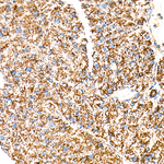 Citrate Synthase Antibody in Immunohistochemistry (Paraffin) (IHC (P))