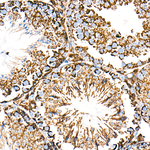 Citrate Synthase Antibody in Immunohistochemistry (Paraffin) (IHC (P))