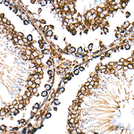 Citrate Synthase Antibody in Immunohistochemistry (Paraffin) (IHC (P))