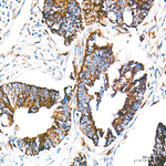 Cathepsin L Recombinant Rabbit Monoclonal Antibody (6P5O9)