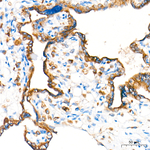 Cathepsin L Antibody in Immunohistochemistry (Paraffin) (IHC (P))