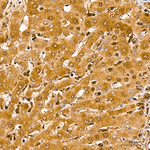 PSMB8 Antibody in Immunohistochemistry (Paraffin) (IHC (P))