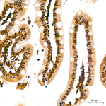 PSMB8 Recombinant Rabbit Monoclonal Antibody (1W6R9)