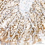 PSMB8 Antibody in Immunohistochemistry (Paraffin) (IHC (P))