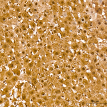 PSMB8 Antibody in Immunohistochemistry (Paraffin) (IHC (P))