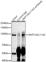 SLC11A2 Antibody in Immunoprecipitation (IP)