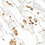 RelB Antibody in Immunohistochemistry (Paraffin) (IHC (P))