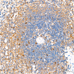 RelB Antibody in Immunohistochemistry (Paraffin) (IHC (P))