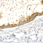 SLC25A5 Antibody in Immunohistochemistry (Paraffin) (IHC (P))