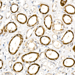 SLC25A5 Antibody in Immunohistochemistry (Paraffin) (IHC (P))