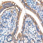 SMPD3 Recombinant Rabbit Monoclonal Antibody (7A4L3)