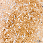 SMPD3 Antibody in Immunohistochemistry (Paraffin) (IHC (P))