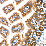 SMPD3 Antibody in Immunohistochemistry (Paraffin) (IHC (P))