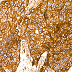 beta-2 Microglobulin Antibody in Immunohistochemistry (Paraffin) (IHC (P))