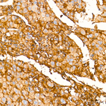 beta-2 Microglobulin Antibody in Immunohistochemistry (Paraffin) (IHC (P))