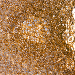 beta-2 Microglobulin Antibody in Immunohistochemistry (Paraffin) (IHC (P))