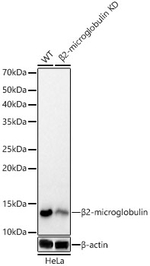 beta-2 Microglobulin Antibody in Western Blot (WB)