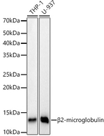beta-2 Microglobulin Antibody in Western Blot (WB)