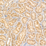USP25 Antibody in Immunohistochemistry (Paraffin) (IHC (P))