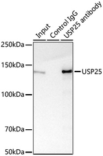 USP25 Antibody in Immunoprecipitation (IP)