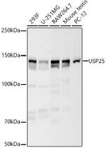 USP25 Antibody in Western Blot (WB)