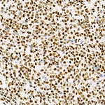 USF1 Antibody in Immunohistochemistry (Paraffin) (IHC (P))