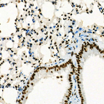 USF1 Antibody in Immunohistochemistry (Paraffin) (IHC (P))
