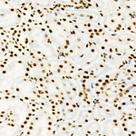USF1 Antibody in Immunohistochemistry (Paraffin) (IHC (P))