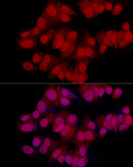 MGMT Recombinant Rabbit Monoclonal Antibody (6Q4H2)