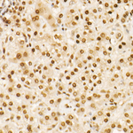 MGMT Antibody in Immunohistochemistry (Paraffin) (IHC (P))