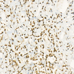 MGMT Antibody in Immunohistochemistry (Paraffin) (IHC (P))
