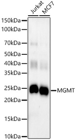 MGMT Antibody in Western Blot (WB)