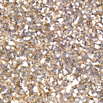 CD200 Antibody in Immunohistochemistry (Paraffin) (IHC (P))
