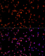 CD68 Antibody in Immunocytochemistry (ICC/IF)