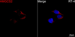HMGCS2 Antibody in Immunocytochemistry (ICC/IF)
