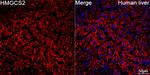 HMGCS2 Antibody in Immunohistochemistry (Paraffin) (IHC (P))