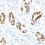 HMGCS2 Antibody in Immunohistochemistry (Paraffin) (IHC (P))