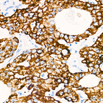 HMGCS2 Antibody in Immunohistochemistry (Paraffin) (IHC (P))