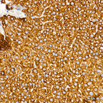 HMGCS2 Antibody in Immunohistochemistry (Paraffin) (IHC (P))