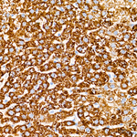 HMGCS2 Antibody in Immunohistochemistry (Paraffin) (IHC (P))