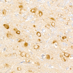 WNK3 Antibody in Immunohistochemistry (Paraffin) (IHC (P))