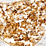 PMEL Antibody in Immunohistochemistry (Paraffin) (IHC (P))