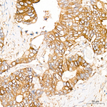 PFKL Recombinant Rabbit Monoclonal Antibody (2F0Z3)