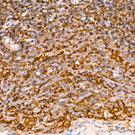 PFKL Antibody in Immunohistochemistry (Paraffin) (IHC (P))