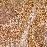 PFKL Antibody in Immunohistochemistry (Paraffin) (IHC (P))