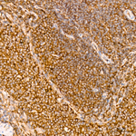 PFKL Antibody in Immunohistochemistry (Paraffin) (IHC (P))