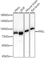 PFKL Antibody in Western Blot (WB)