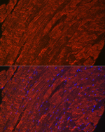 Phospholamban Antibody in Immunohistochemistry (Paraffin) (IHC (P))