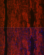 Phospholamban Recombinant Rabbit Monoclonal Antibody (3A8Q9)