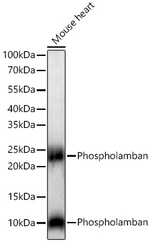 Phospholamban Antibody in Western Blot (WB)